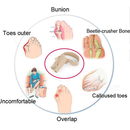 Orthopedic Bunion Aid