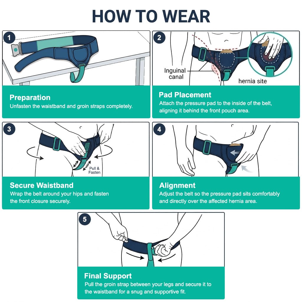 Five-step instructional diagram showing how to prepare, position, and securely fasten the SUPEAK hernia belt, ensuring the pressure pad sits directly over the inguinal canal for optimal support.
